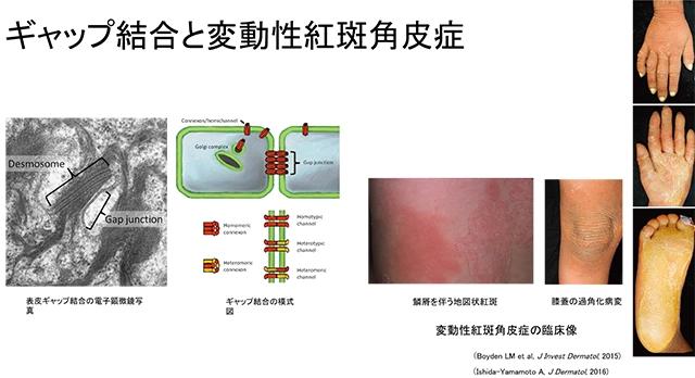 皮膚におけるコネキシンの機能に関する研究